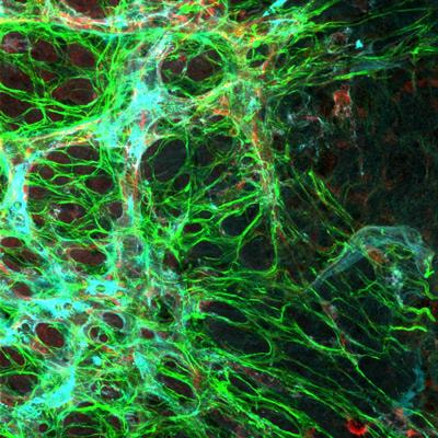 Cover image for research topic "The Role of Astrocyte in Vascular Aging"