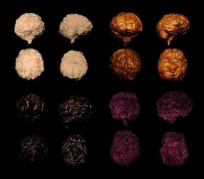 Cover image for research topic "Neuroaesthetics: Neuroscience of aesthetics"