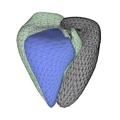 Cover image for research topic "Added Value of 3D Imaging in the Diagnosis and Prognostication of Patients with Right Ventricular Dysfunction"
