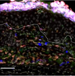 Cover image for research topic "Cellular and Molecular Communication Networks within the Cutaneous Immune System"