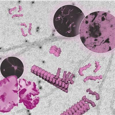 Cover image for research topic "The Biochemistry of Amyloids in Neurodegenerative Diseases, Volume II"