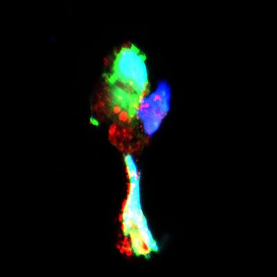 Cover image for research topic "The Role of Leukocyte Extracellular Traps in Inflammation and Autoimmunity"