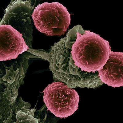Cover image for research topic "The Relationship between Autoimmune Diseases and Immunological Tolerance During Pregnancy"