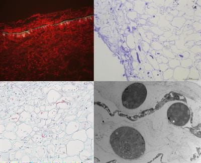 Cover image for research topic "Necrotrophic Fungal Plant Pathogens, Volume II"
