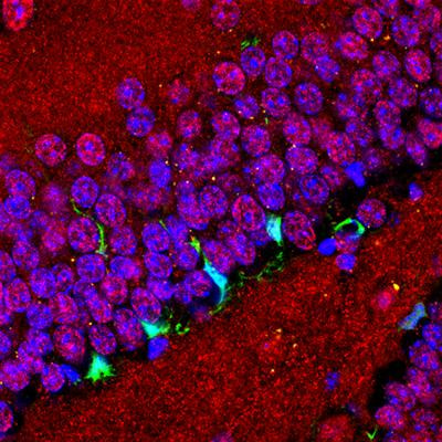 Cover image for research topic "Cell fate determinants in adult neurogenesis."