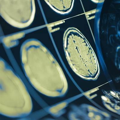 Cover image for research topic "Insights in Brain Imaging Methods: 2021"