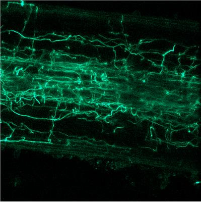 Cover image for research topic "Beneficial Microbes and the Interconnection Between Crop Mineral Nutrition and Induced Systemic Resistance, Volume II"