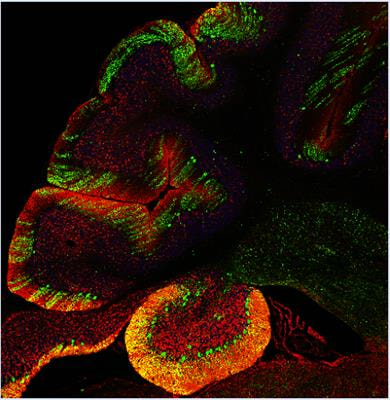 Cover image for research topic "Neuronopathic Lysosomal Storage Diseases - Specific Neuronal Characteristics and Therapeutic Approaches"