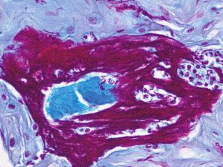 Cover image for research topic "Biomaterials for Microenvironment Immunomodulation"