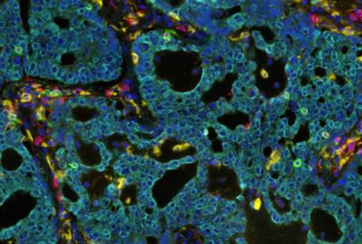 Cover image for research topic "Multiplexed Image Analysis for Translational Research Project Applications"