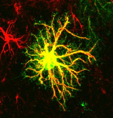 Cover image for research topic "Crosstalk between the osteogenic and neurogenic stem cell niches: how far are they from each other?"