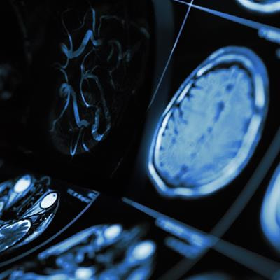 Cover image for research topic "Insights in Neurodevelopment: 2021"