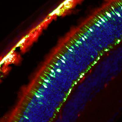 Cover image for research topic "Rare and Common Neurodegenerative Retinal Diseases: From Molecular Mechanisms to the Identification of Novel Mutation-independent Therapeutic Strategies"