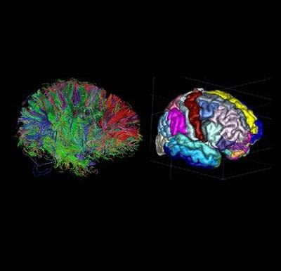 Cover image for research topic "Novel Tools for the Study of Structural and Functional Networks in the Brain"