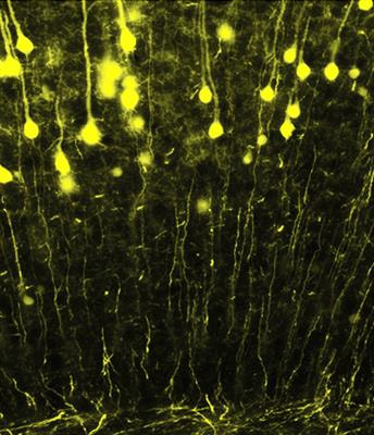Cover image for research topic "Kinase/phosphatase signaling and axonal function in health and disease"
