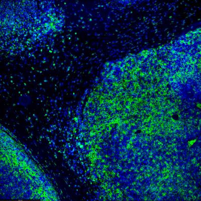 Cover image for research topic "Current Concepts of Cellular and Biological Drugs to Modulate Regulatory T cell Activity in the Clinic, volume II"