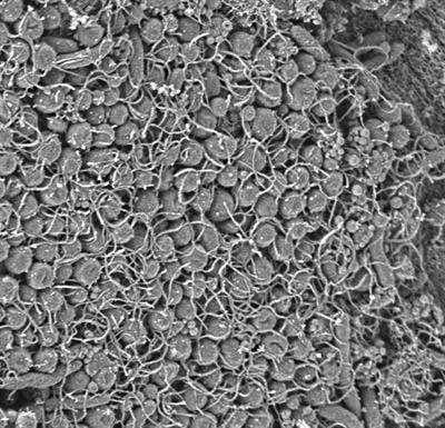 Cover image for research topic " Helicobacter pylori  and Its Mechanisms of Antibiotic Survival"