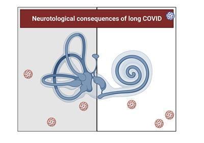 Cover image for research topic "Neurotological Consequences of Long COVID"