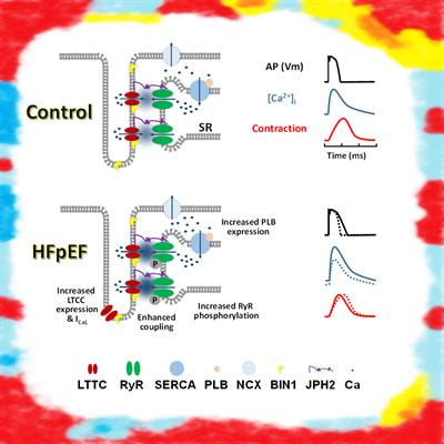 Cover image for research topic "Heart failure with preserved ejection fraction : Basic, Translational, and Clinical Research"