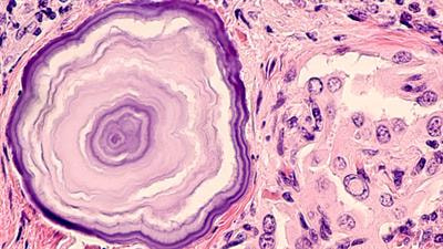 Cover image for research topic "Targeting Different Programmed Cell Death Processes as Therapeutic Modalities for Thyroid Cancer"