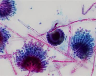 Cover image for research topic "Emergence of Antifungal Resistance: an international call for prevention"