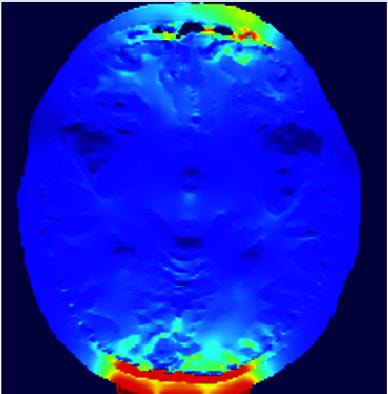 Cover image for research topic "Image-based Planning of Electric Neurological Treatments"