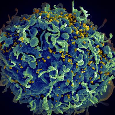 Cover image for research topic "AIDS 40th Year"