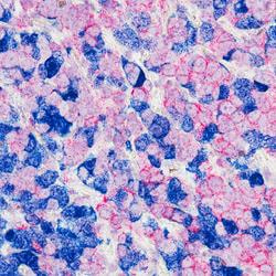Cover image for research topic "Hormones and Receptors in Breast Cancer"