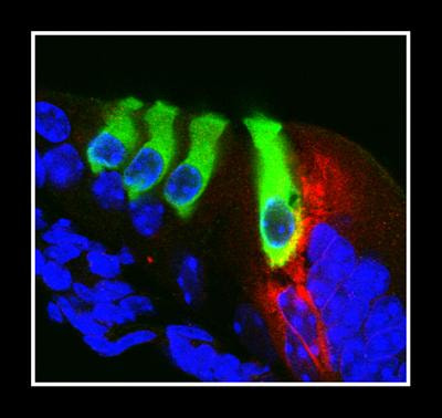 Cover image for research topic "Aging, neurogenesis and neuroinflammation in hearing loss and protection"