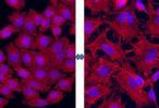 Cover image for research topic "Cellular and Phenotypic Plasticity in Cancer"