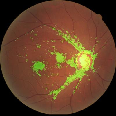 Cover image for research topic "Big Data and Artificial Intelligence in Ophthalmology"