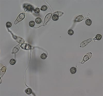 Cover image for research topic "Molecular mechanism in the development and pathogenesis of fungi"