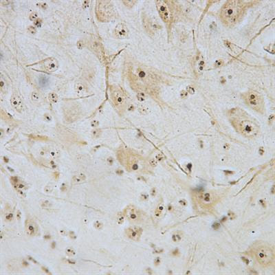 Cover image for research topic "Molecular Perspectives in Traumatic Brain, Spinal cord and Nerve injuries"