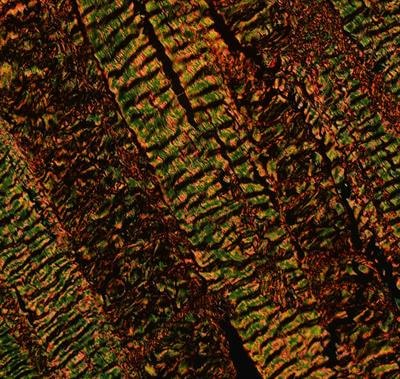 Cover image for research topic "Intervertebral disc degeneration and osteoarthritis: mechanisms of disease and functional repair"