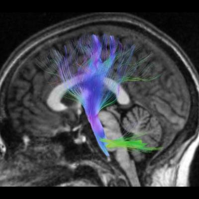 Cover image for research topic "Trends in Biomarkers for Neurodegenerative Diseases: Current Research and Future Perspectives"