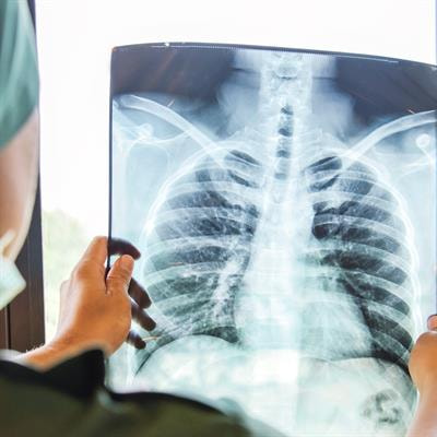 Cover image for research topic "Thoracic Surgery in Cancer: Case Reports 2021"