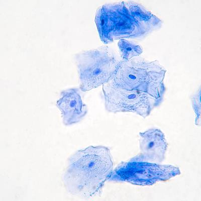 Cover image for research topic "Cutaneous Oncology and Skin Cancer Genomics"