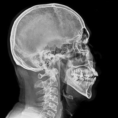 Cover image for research topic "Bone and Metabolic Activities"