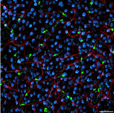 Cover image for research topic "Glial cells and inflammation: the fine intersection to initiation and progression of neuronal damage"