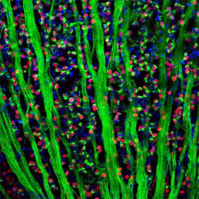 Cover image for research topic "Molecular and cellular players of axonal regeneration in injured CNS"