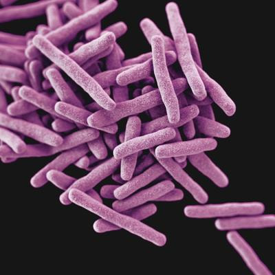 Cover image for research topic "Tuberculosis: Host Immunity, Diagnostics and Therapeutics"