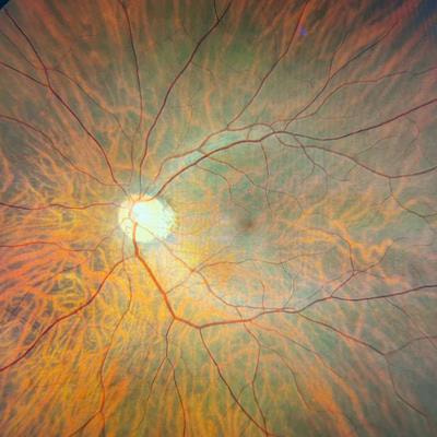 Cover image for research topic "Women in Retina: 2022"
