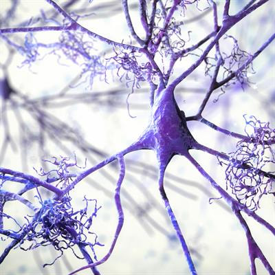 Cover image for research topic "The Affective Side of Alzheimer’s Disease (AD): Neuropsychiatric Symptoms as Early Sentinel of Cognitive Decline and Pathogenetic Factors in Disease Progression"