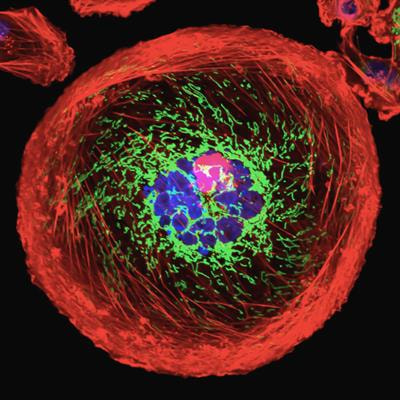 Cover image for research topic "Multi-Omics Approaches in Cancer Research with Applications in Tumour Prognosis, Metastasis and Biosensor Based Diagnosis of Biomarkers"