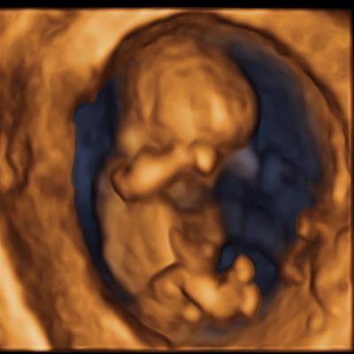 Cover image for research topic "Advances in Maternal and Fetal Medicine in Latin America"