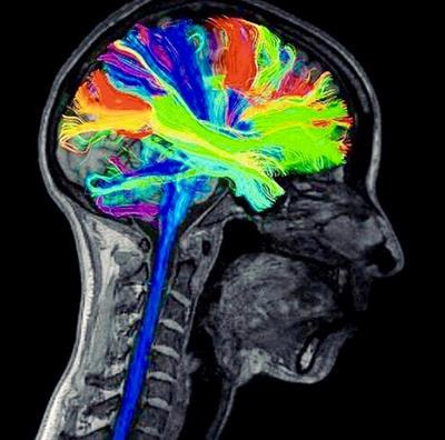 Cover image for research topic "Dynamic Functioning of Resting State Networks in Physiological and Pathological Conditions, volume II"