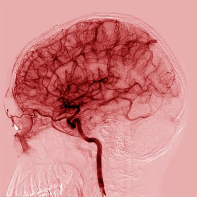 Cover image for research topic "Women In Brain Imaging and Stimulation"