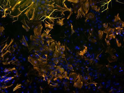 Cover image for research topic "Molecular mechanisms and innovative therapeutic strategies for frontotemporal lobar degeneration"