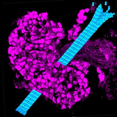 Cover image for research topic "Tubulinopathies: Fundamental and Clinical Challenges"