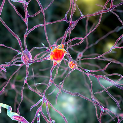 Cover image for research topic "New Insight into Huntington’s disease: from Neuropathology to Possible Therapeutic Targets"